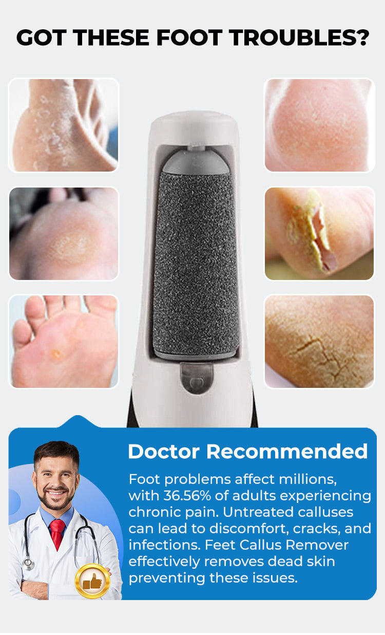Electric Feet Callus Remover